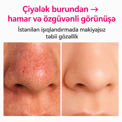 ClarifyPro - Qara Nöktə Təmizləyici Vakum Cihazı
